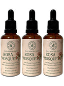 Óleo Vegetal Puro de Rosa Mosqueta 50ml – Canteiro de Ervas